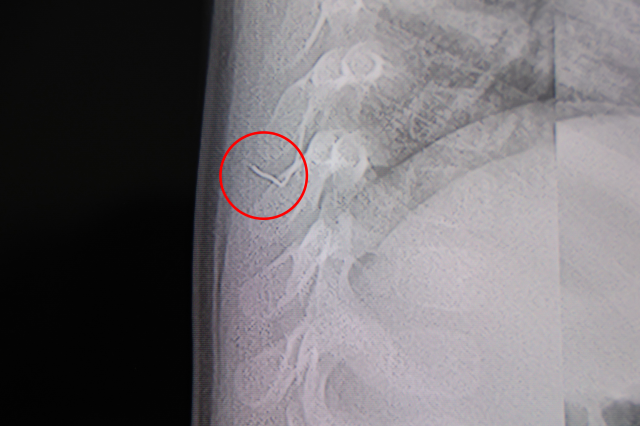 1 yaşındaki bebek sırtüstü yatırıldıkça ağladı! Gerçeği gören aile şoke oldu