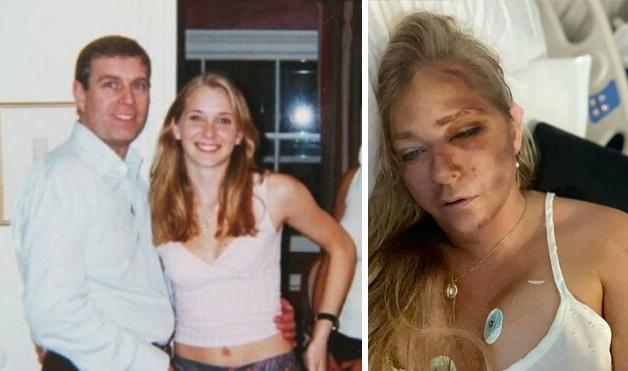 Shocking detail about Prince Andrew in the new Epstein documents! Leaning over the woman on the ground