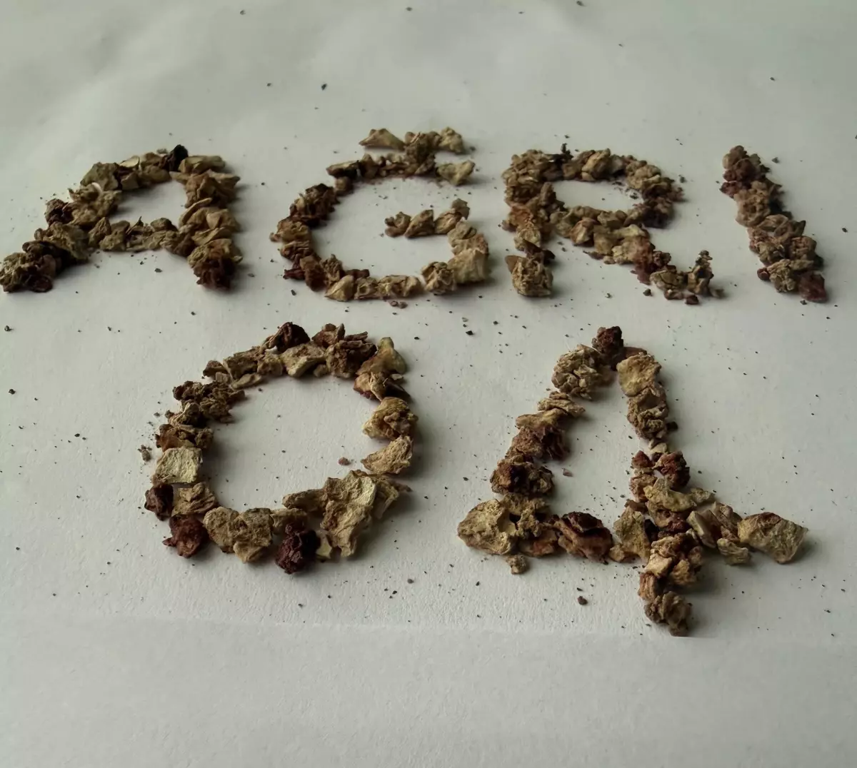 Daha önce 21 kez böbrek taşı operasyonu geçiren hastadan 295 taş çıkarıldı