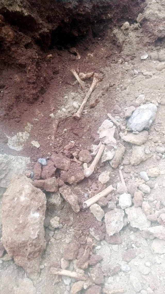 Altyapı çalışmasında insana ait olduğu değerlendirilen kemikler bulundu