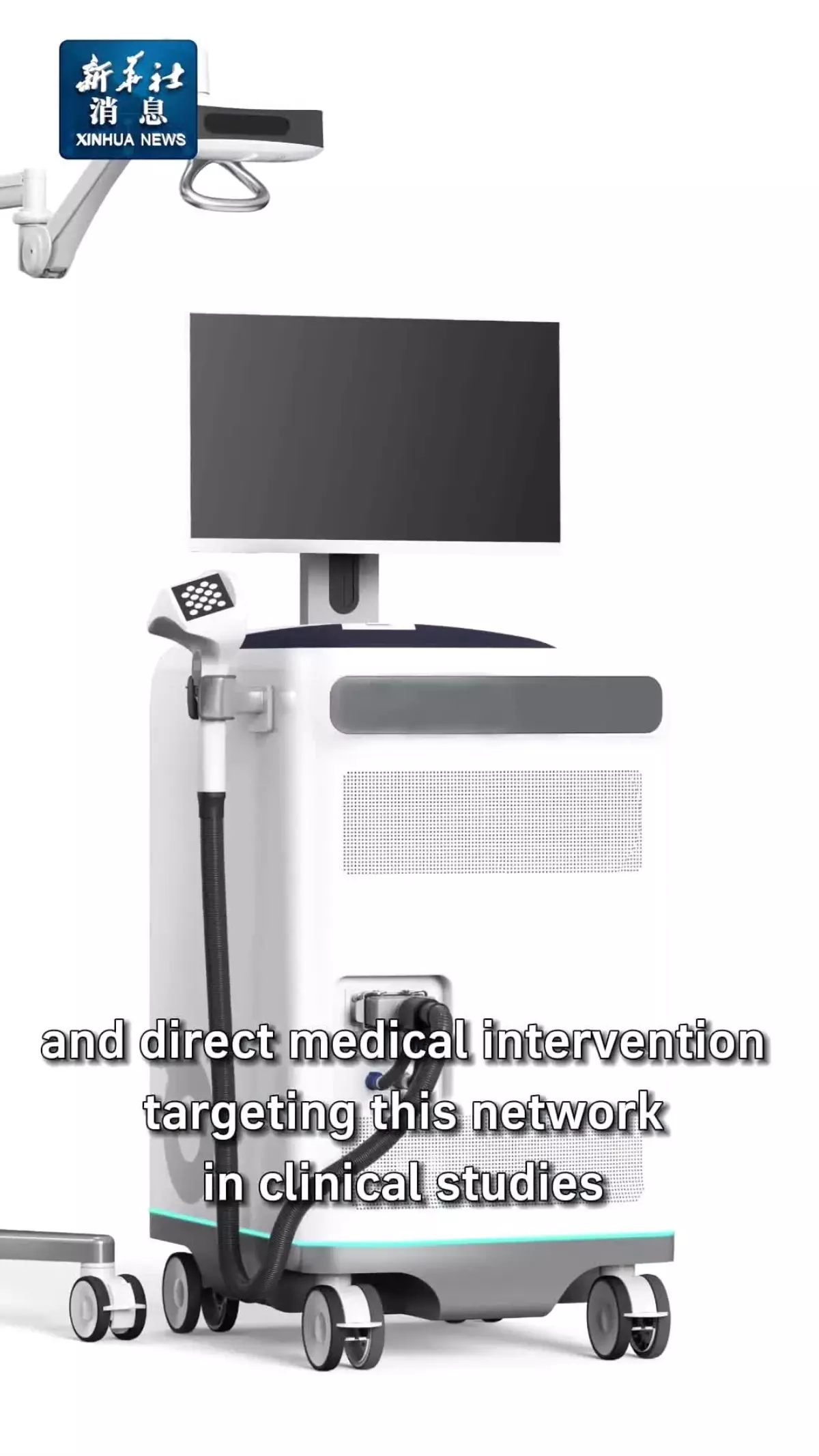 Çinli Bilim İnsanları Parkinson Hastalığının Altında Yatan Patolojik Beyin Ağını Belirledi