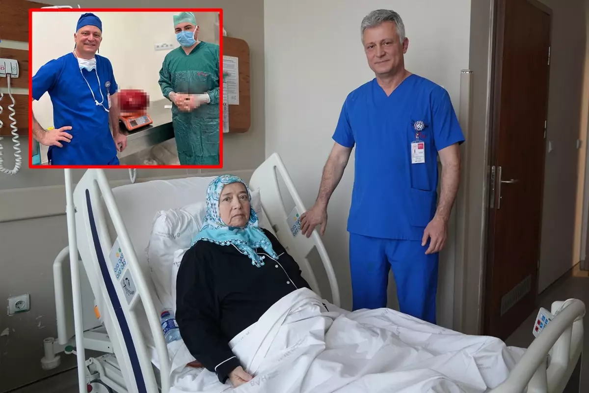 Görenler kilo aldı sandı, karnından 30 santim uzunluğunda 10,5 kiloluk kitle çıktı