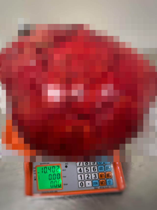 gorenler kilo aldi sandi karnindan 30 santim 19541117 9684 m