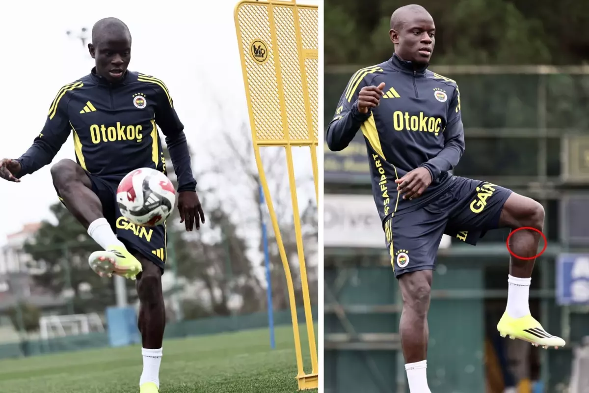 Kante Fenerbahçe'de ilk antrenmanına çıktı! Her gören bacağındaki detaya takıldı