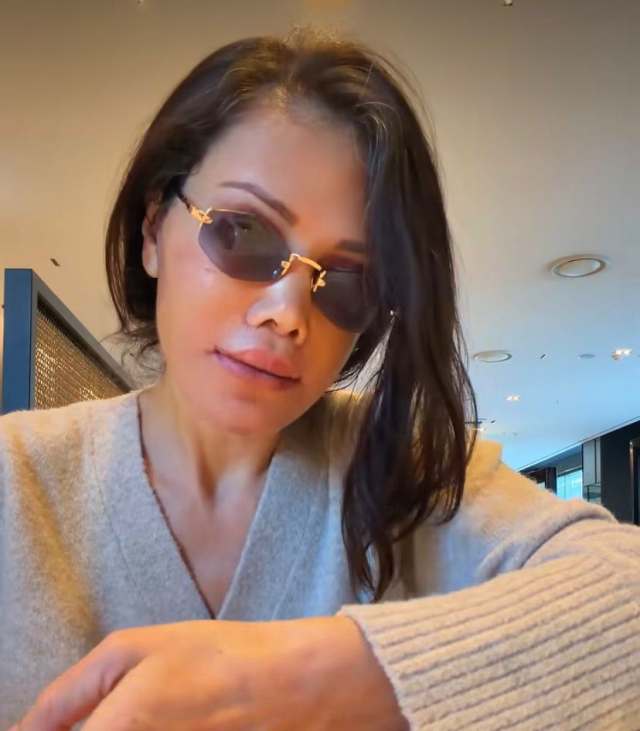 Didem Ceran's latest look after the face transplant: I look amazing