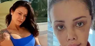 Yüz nakli yaptıran Didem Ceran'ın son hali: Harika gözüküyorum