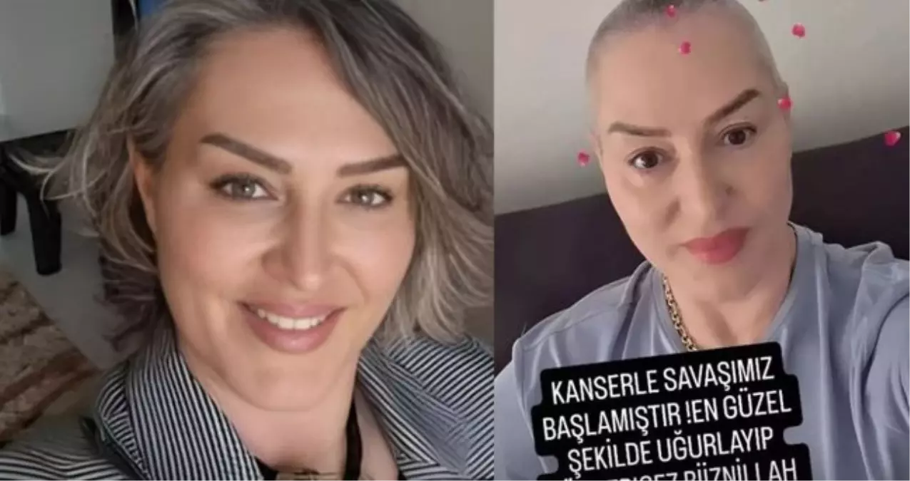 Şıvga Gerez ne kanseri? Şıvga Gerez'in hastalığı ne, neden vefat etti?