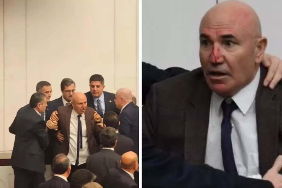 Meclis'teki kavgada Mahmut Tanal'ın burnu kanadı