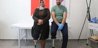 Ampute protez teknikeri kendisi gibi uzuv kaybı yaşayanlara umut oluyor