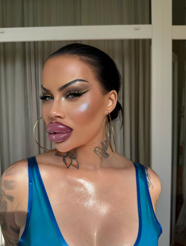 The phenomenon who spent 60 thousand dollars on aesthetics: I can no longer close my mouth