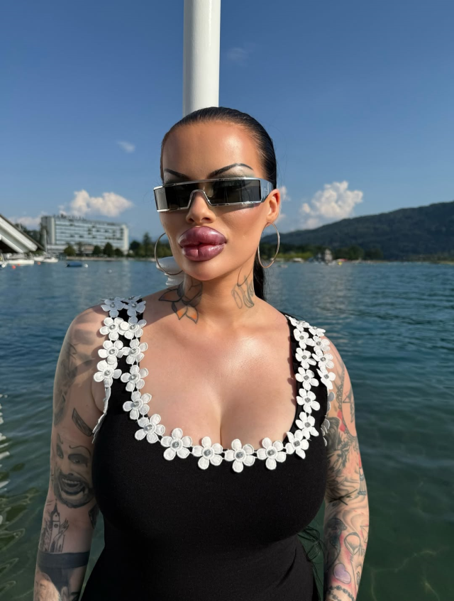 The phenomenon who spent 60 thousand dollars on aesthetics: I can no longer close my mouth