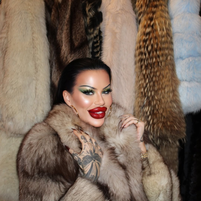 The phenomenon who spent 60 thousand dollars on aesthetics: I can no longer close my mouth