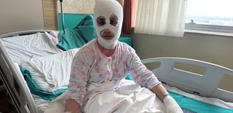 İftara hazırlık sırasında patlayan düdüklü tencere iki çocuk annesini hastanelik etti