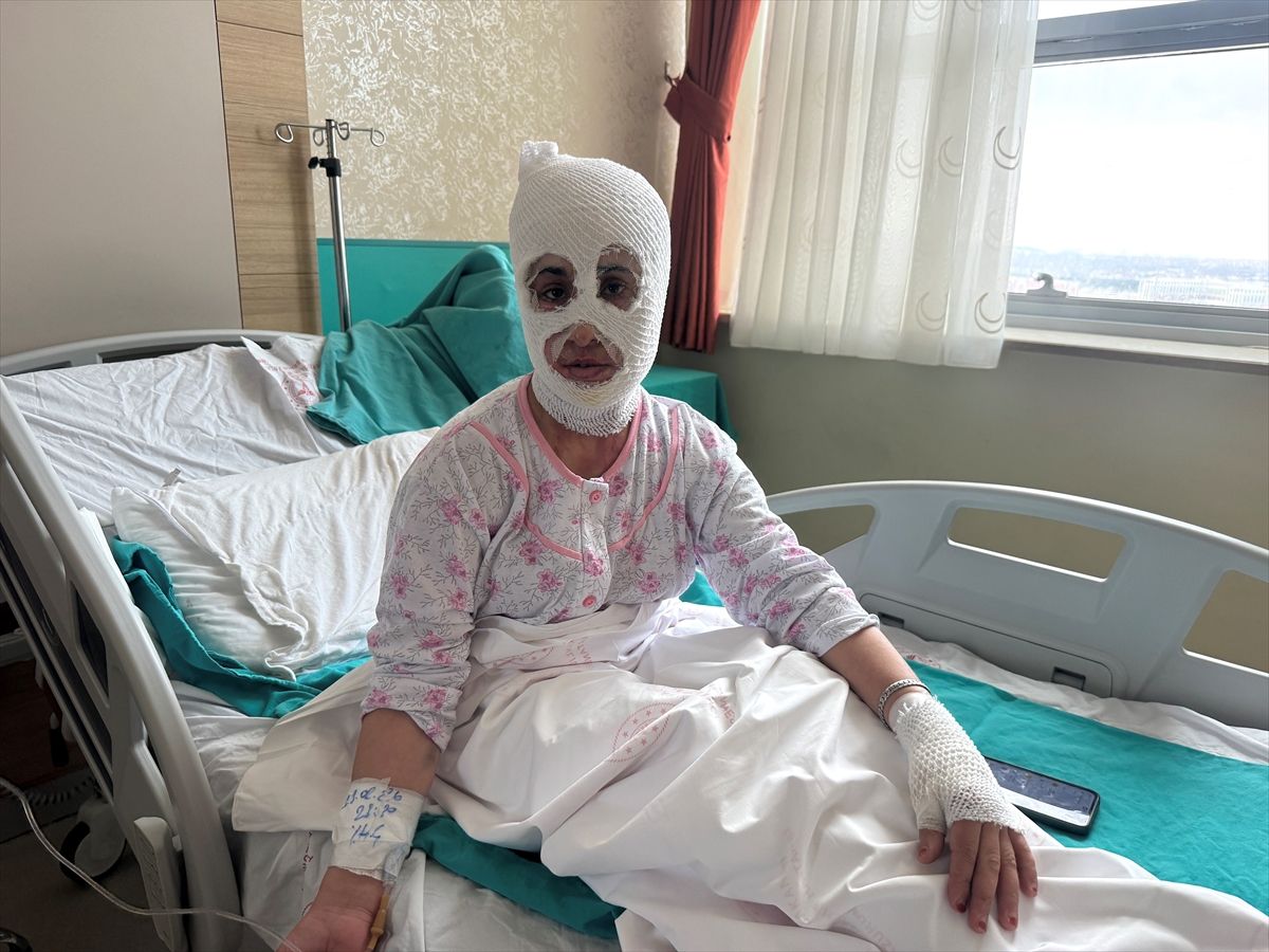 İftara hazırlık sırasında patlayan düdüklü tencere iki çocuk annesini hastanelik etti