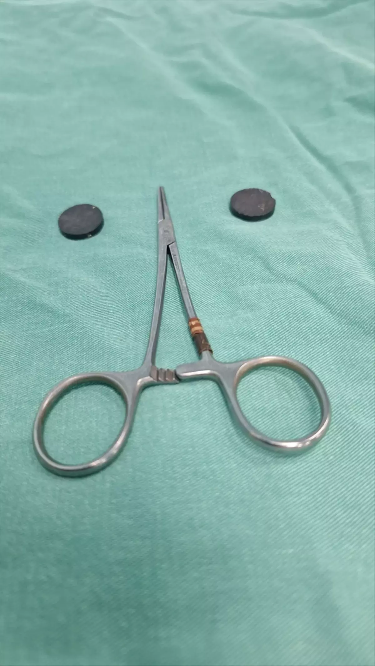 Karaman'da tuvaletini yapamayan çocuğun bağırsağından iki mıknatıs çıkarıldı