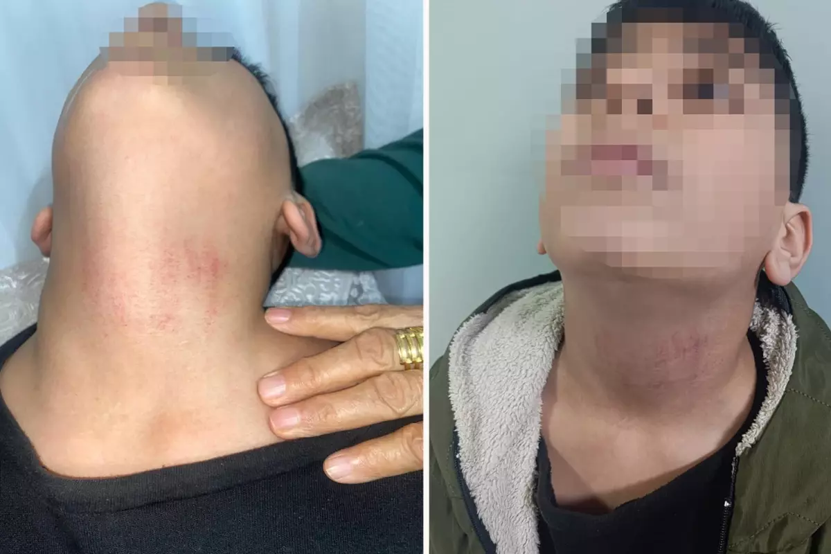 Küçükçekmece'de kadın memurun 10 yaşındaki öğrenciyi okulda darbettiği iddiası