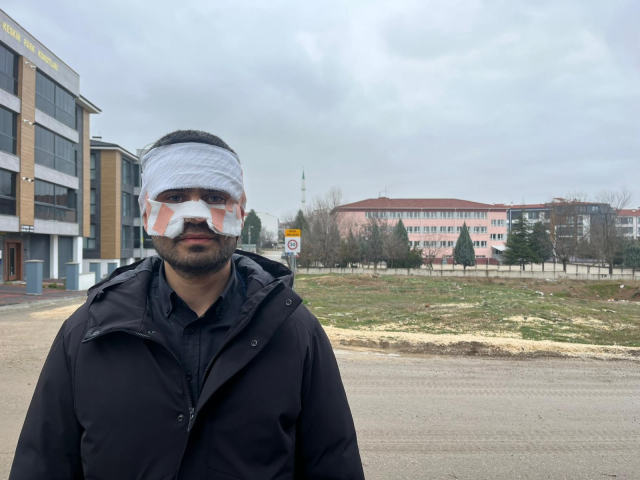 The physics teacher who threw hot tea in the guidance teacher's face was severely burned