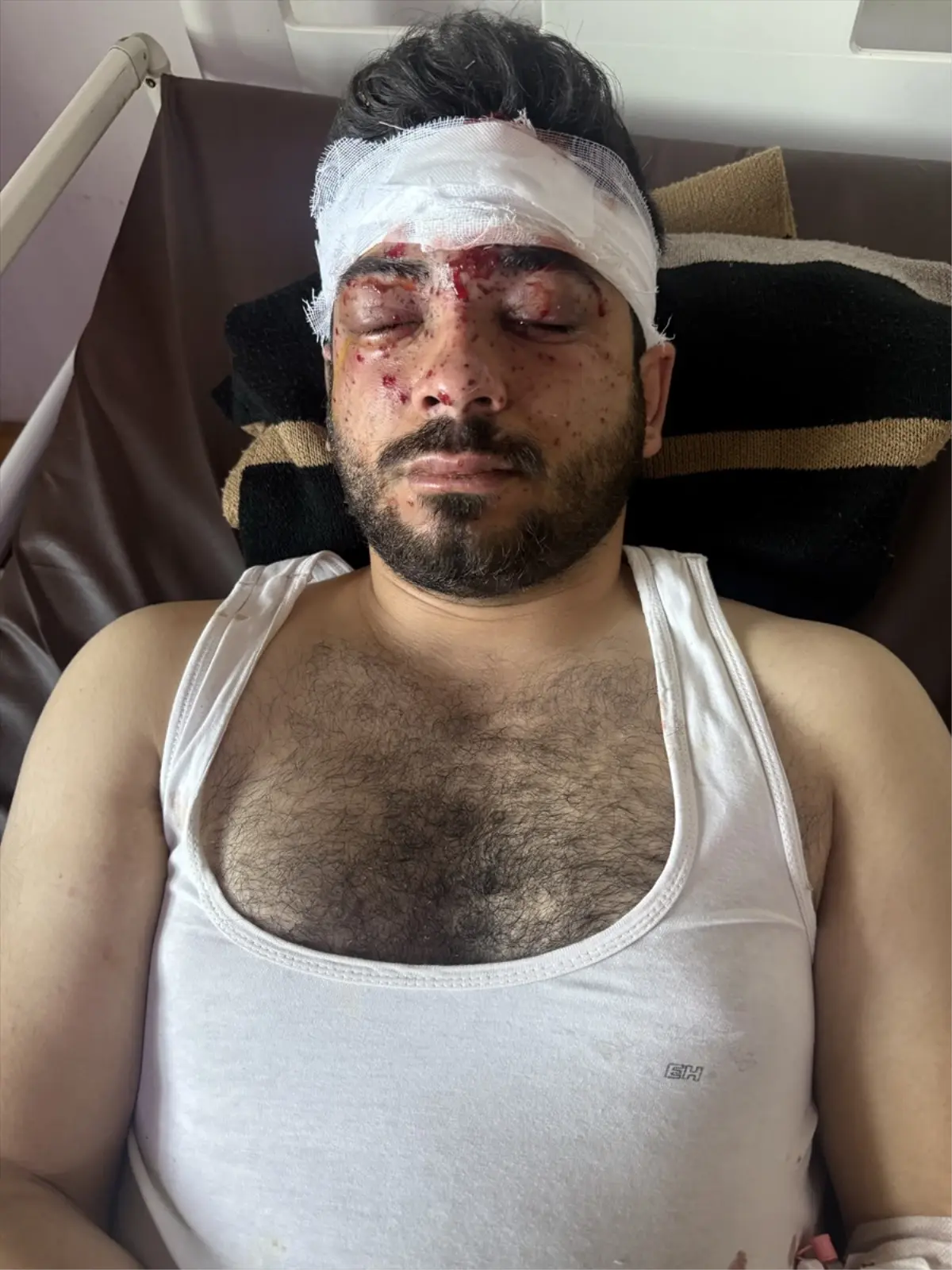 Suriye'de mayın temizleme sırasındaki patlamada AA muhabiri dahil 3 kişi yaralandı