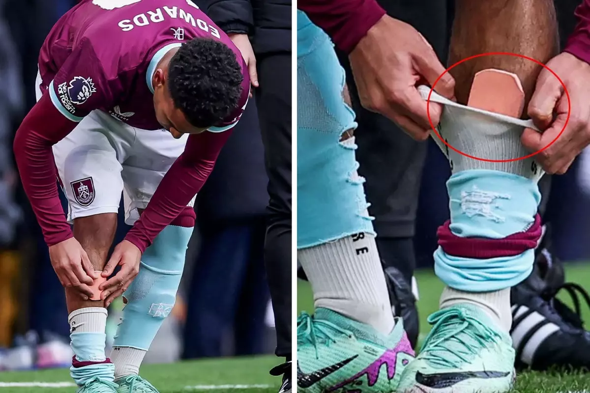 Herkes aynı yorumu yapıyor! Tarihi maça damga vuran kare