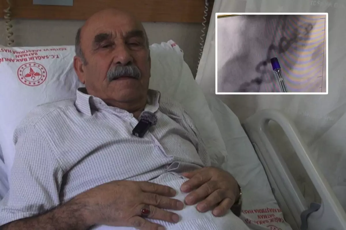 Göğüs yanması şikayetiyle gittiği hastanede kalbinden kan 'çalan' damar bulundu
