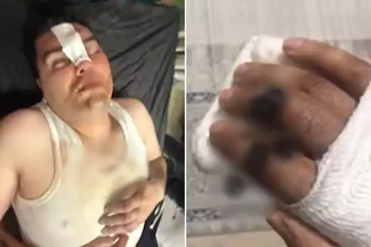 Hesabı ortak ödediler, dayağı tek başına yedi! Her şey 13 binlik "çerez" ile başladı