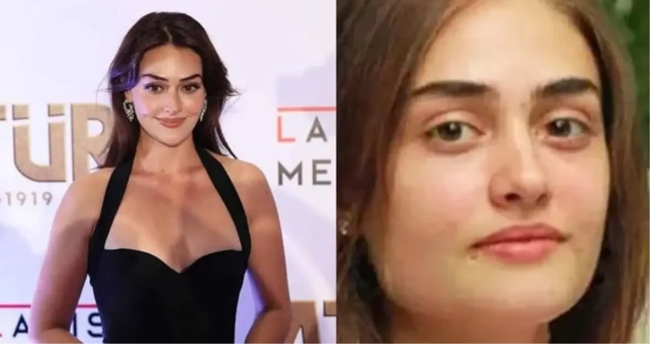 Esra Bilgiç estetik yaptırdı mı? Esra Bilgiç kimdir, kaç yaşında, nereli?