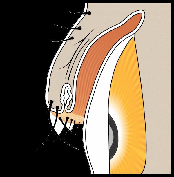 Kirpikler Gözünüze Batıyorsa Dikkat: Trikiyazis Göz Sağlığını Tehdit Ediyor Kirpikler Gözünüze Batıyorsa Dikkat: Trikiyazis Göz Sağlığını Tehdit Ediyor