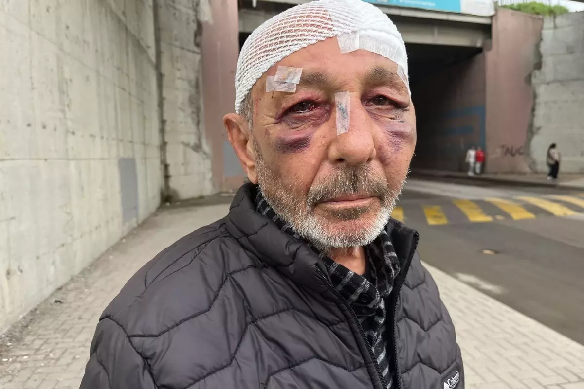 Çakmak istediler verdi, sonrasında bu hale geldi