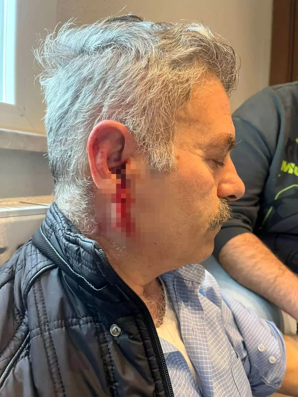 Silivri'de özel bakım merkezine çağrılan eski çalışan darbedildi