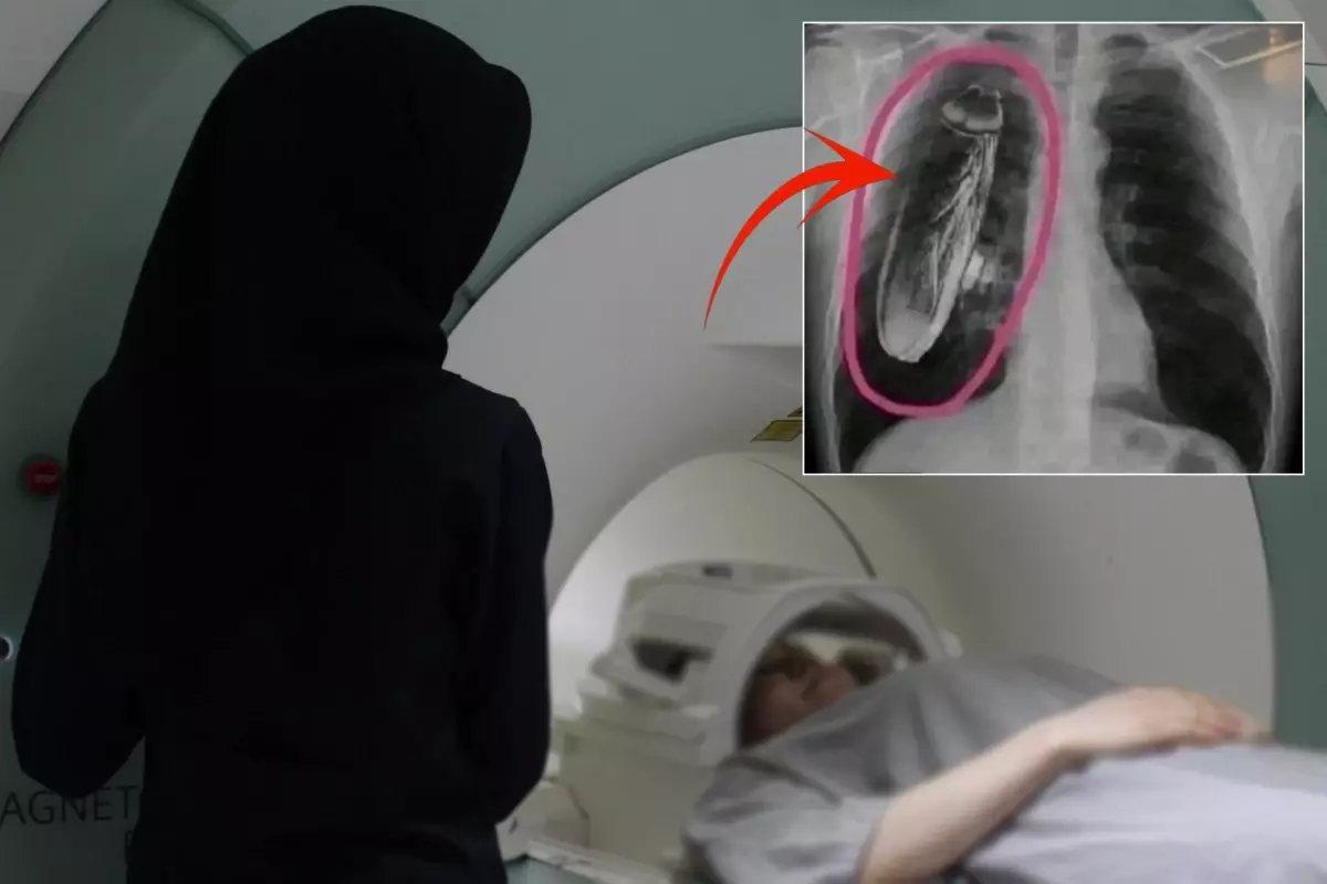 Hastaya "Göğsünde canlı böcek var" dendi, gerçek çok başka çıktı