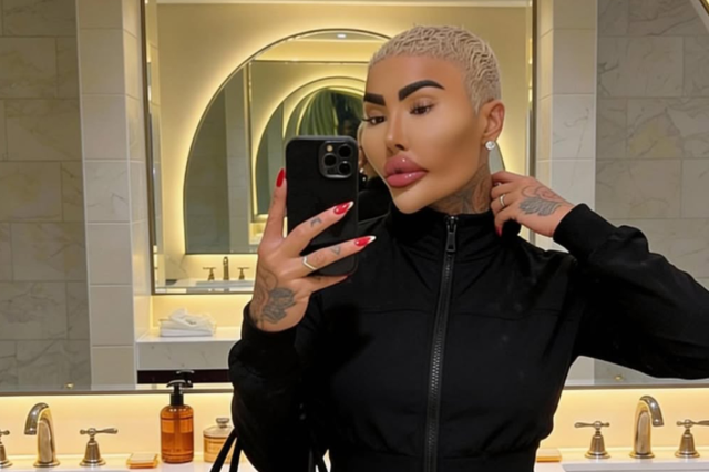 kim kardashian a benzemek icin estetik yaptiran 19595619 9172 m