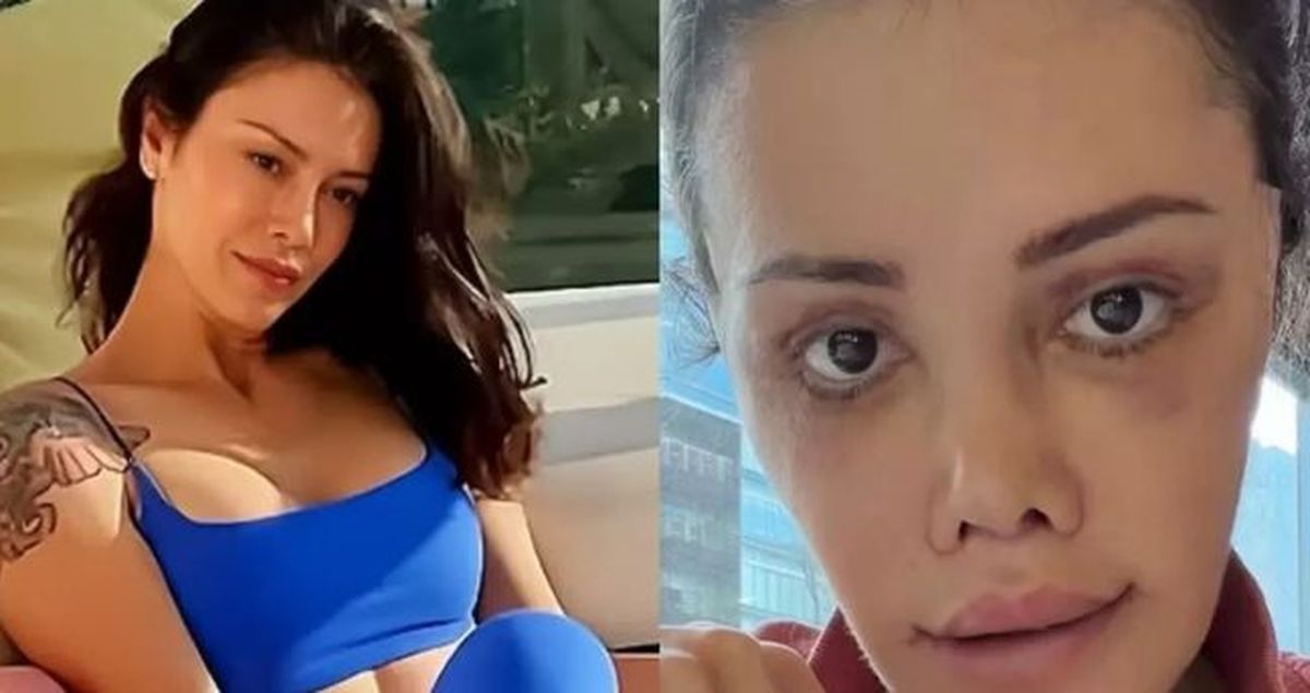 DİDEM CERAN'IN ESKİ HALİ: Didem Ceran yüz nakli yaptırmadan önce nasıldı, Didem Ceran'ın yüzünde kaç tane ...