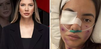 Fulya Öztürk trafik kazası mı geçirdi? Elden ele dolaşan görselle ilgili açıklama var
