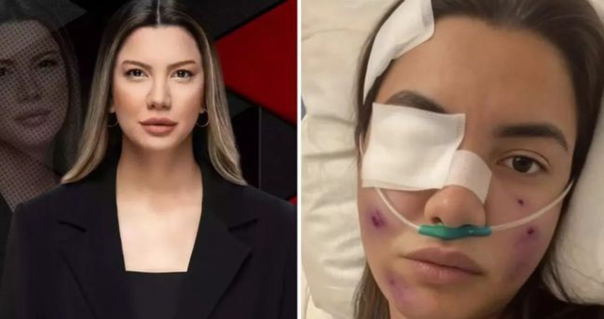 Fulya Öztürk trafik kazası mı geçirdi, görüntüler yapay zeka ile mi yapıldı? Fulya Öztürk ne açıklama yaptı?