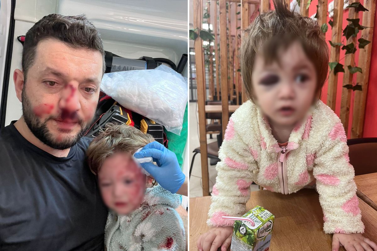 İşte 14 aylık İkra bebeği hastanelik edenlere istenen ceza! Skuter silah sayıldı