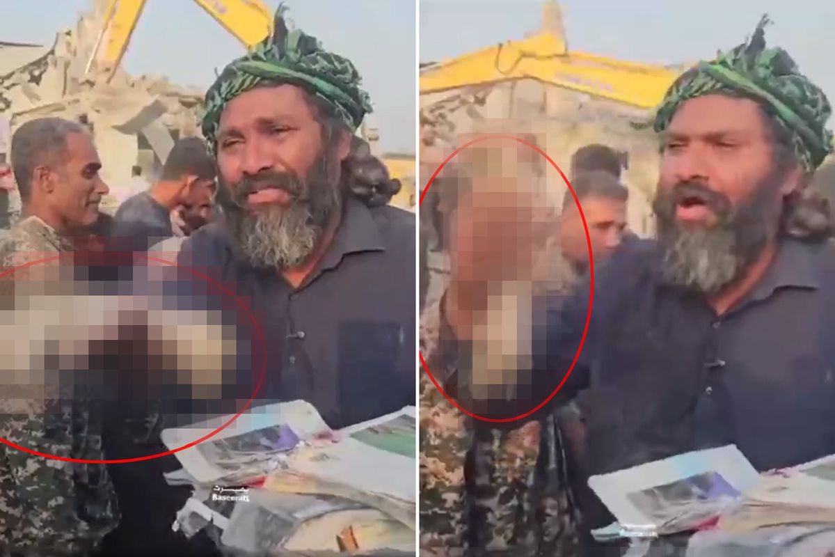 İran'da İlkokulda öldürülen kız çocuğunun kopan elini gösterip isyan etti: Dünya bu cinayeti görmeli