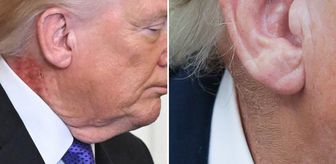 Trump'ın boynundaki kızarıklığı gizleme çabası