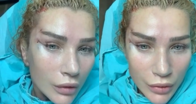 Seda Sayan estetik mi yaptırdı, yüzünde kaç tane estetik var? Seda Sayan yüzüne ne yaptırdı, kaç tane estetik operasyonu geçirdi?