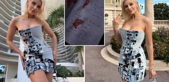Ayşegül Eraslan'ın ölümünde kan donduran iddia! Arkadaşı otopsi raporunu paylaştı