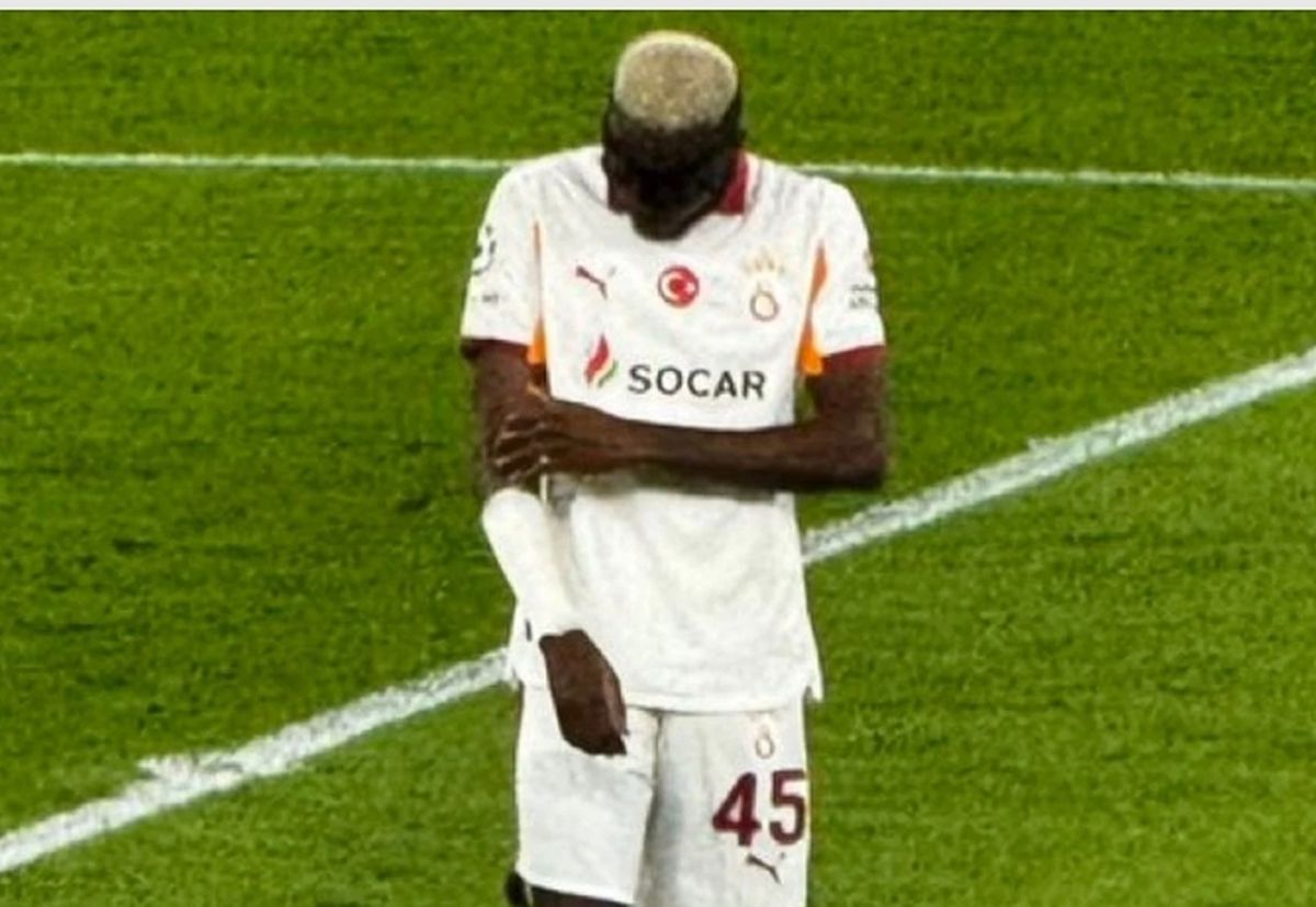 Osimhen neden yok, Osimhen oyundan çıktı mı (Liverpool Galatasaray)?
