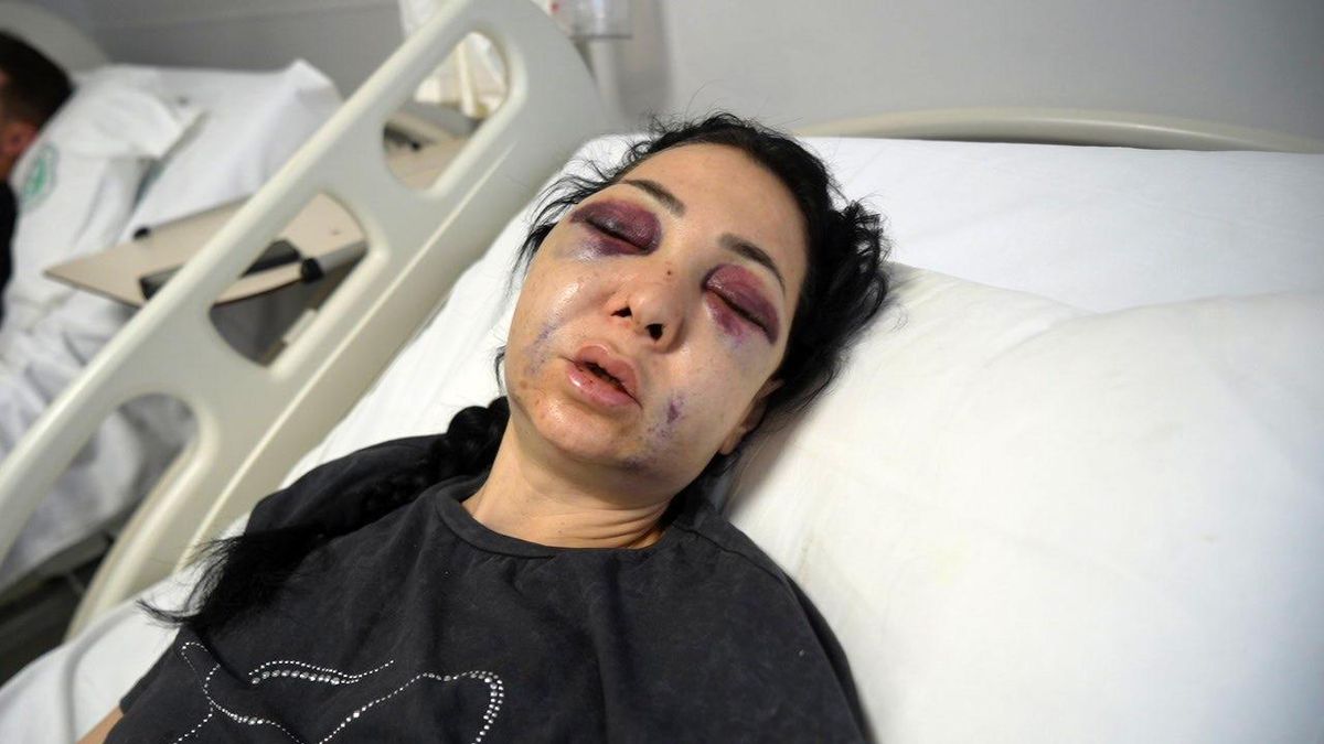 Anne ve oğlunun darp edilmesine ilişkin gözaltına alınan 3 şüpheliden 1'i tutuklandı