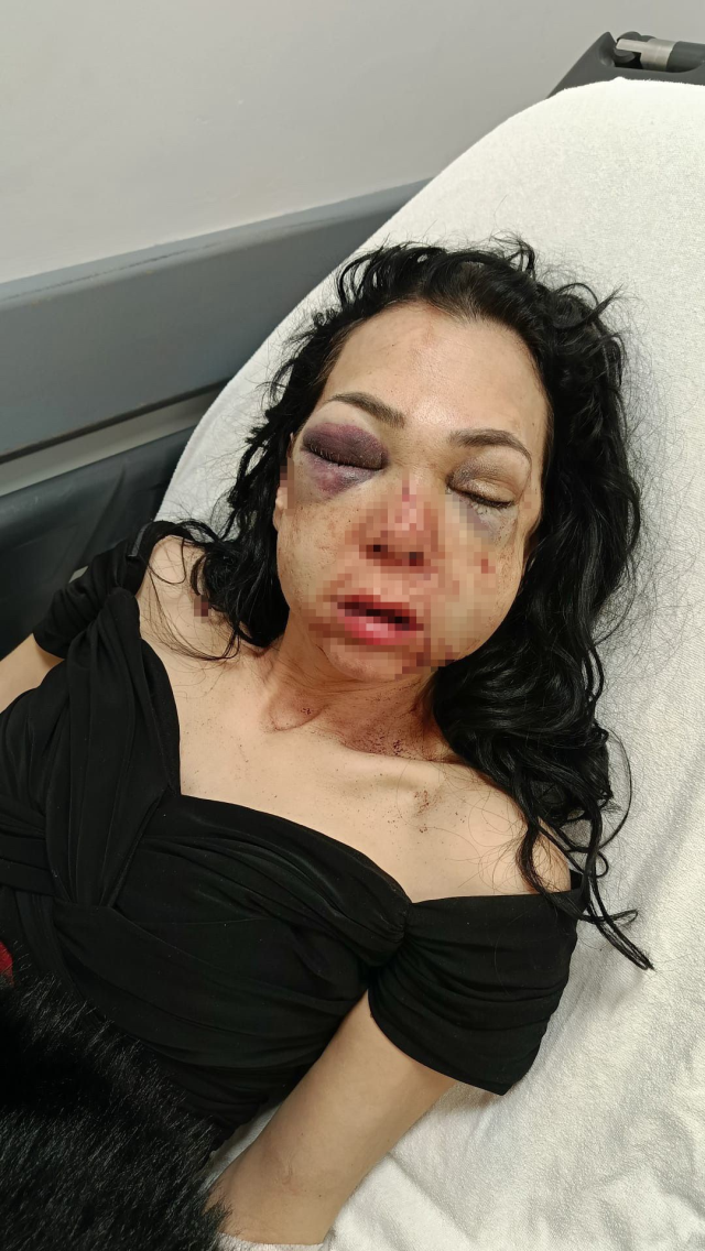 Oğlunun gözü önünde anneyi öldüresiye dövdüler: Küfür etmeyin dedik diye bu hale geldim 4 oglunun gozu onunde anneyi olduresiye dovduler 19678515 6967 m