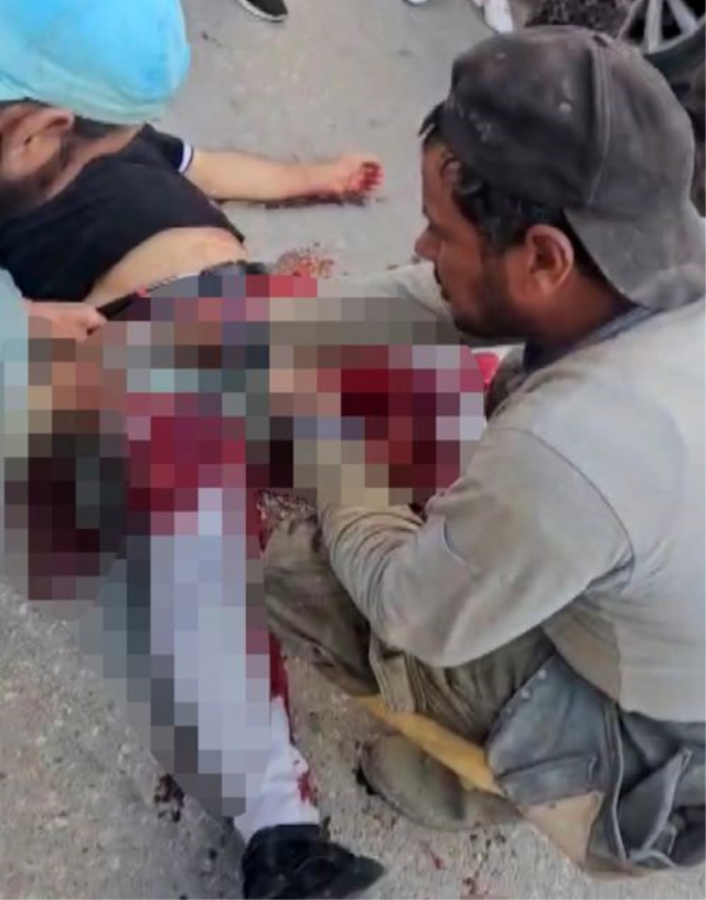 أطلق النار على خصمه في فخذه