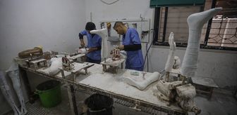 İsrail ablukası altındaki Gazze'de Filistinliler protez uzva kavuşmak için aylarca bekliyor