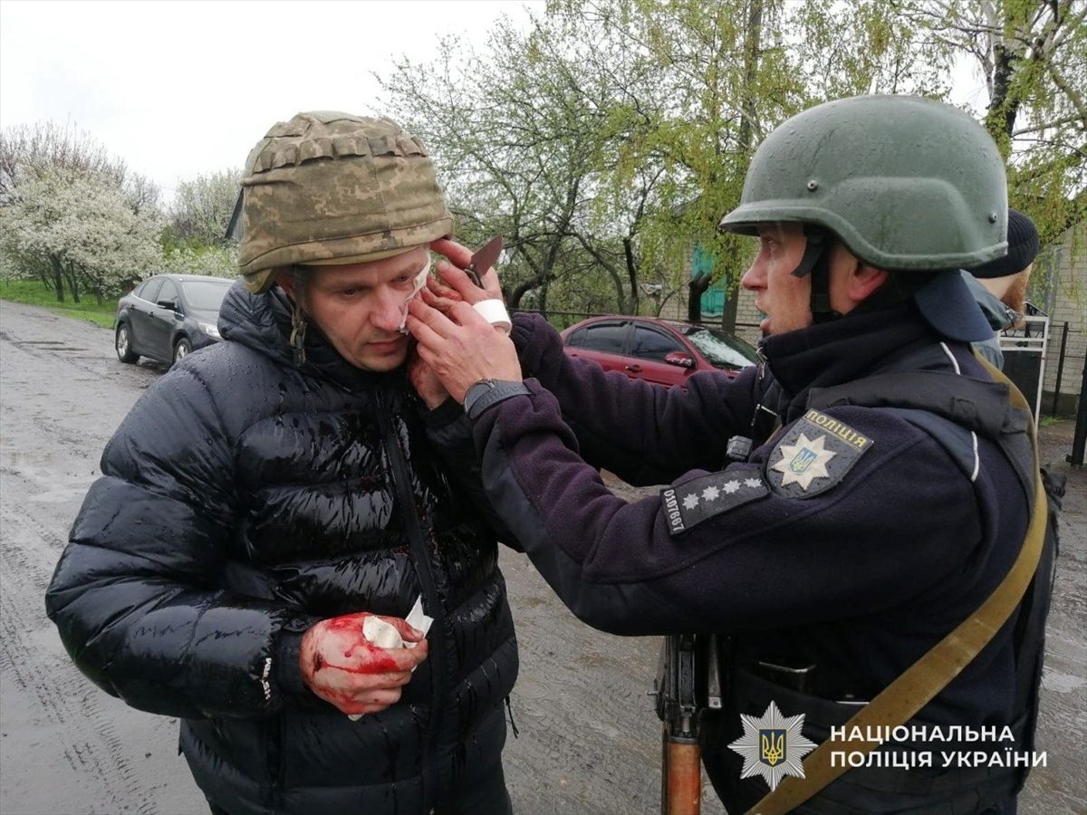 Ukrayna'da bir kişinin el bombalı saldırısında 5 polis yaralandı