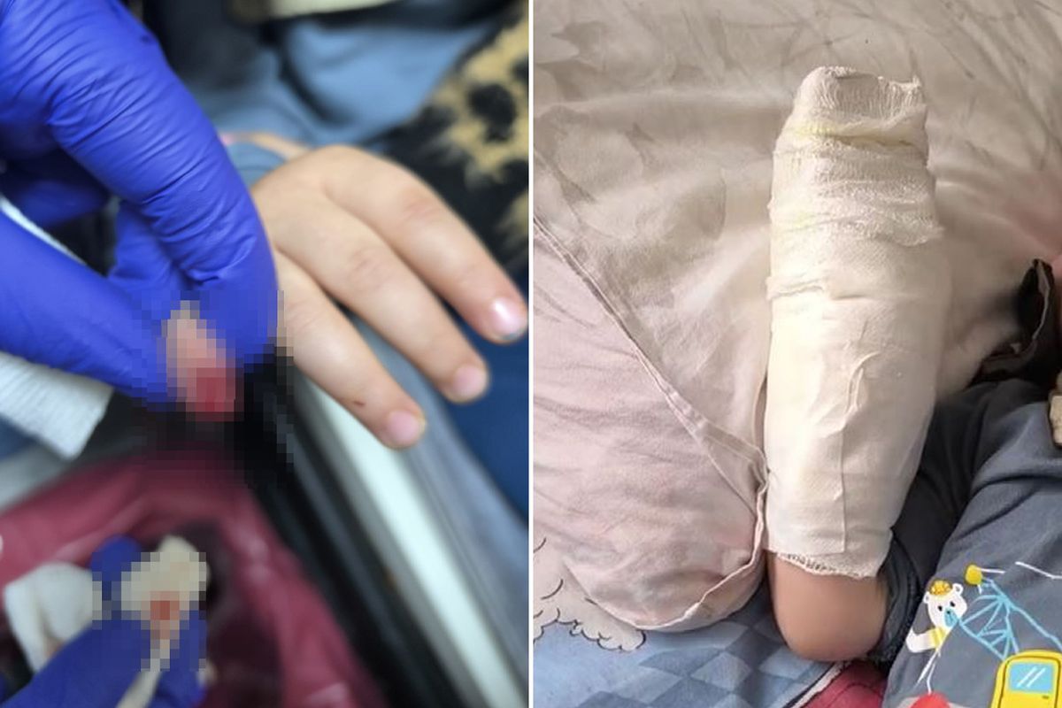 AVM'de yürüyen merdivene eli sıkışan çocuğun parmağı koptu