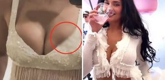 Milyonlarca hayranı bu sorunun cevabını arıyor: Kylie Jenner’ın silikonu mu patladı?