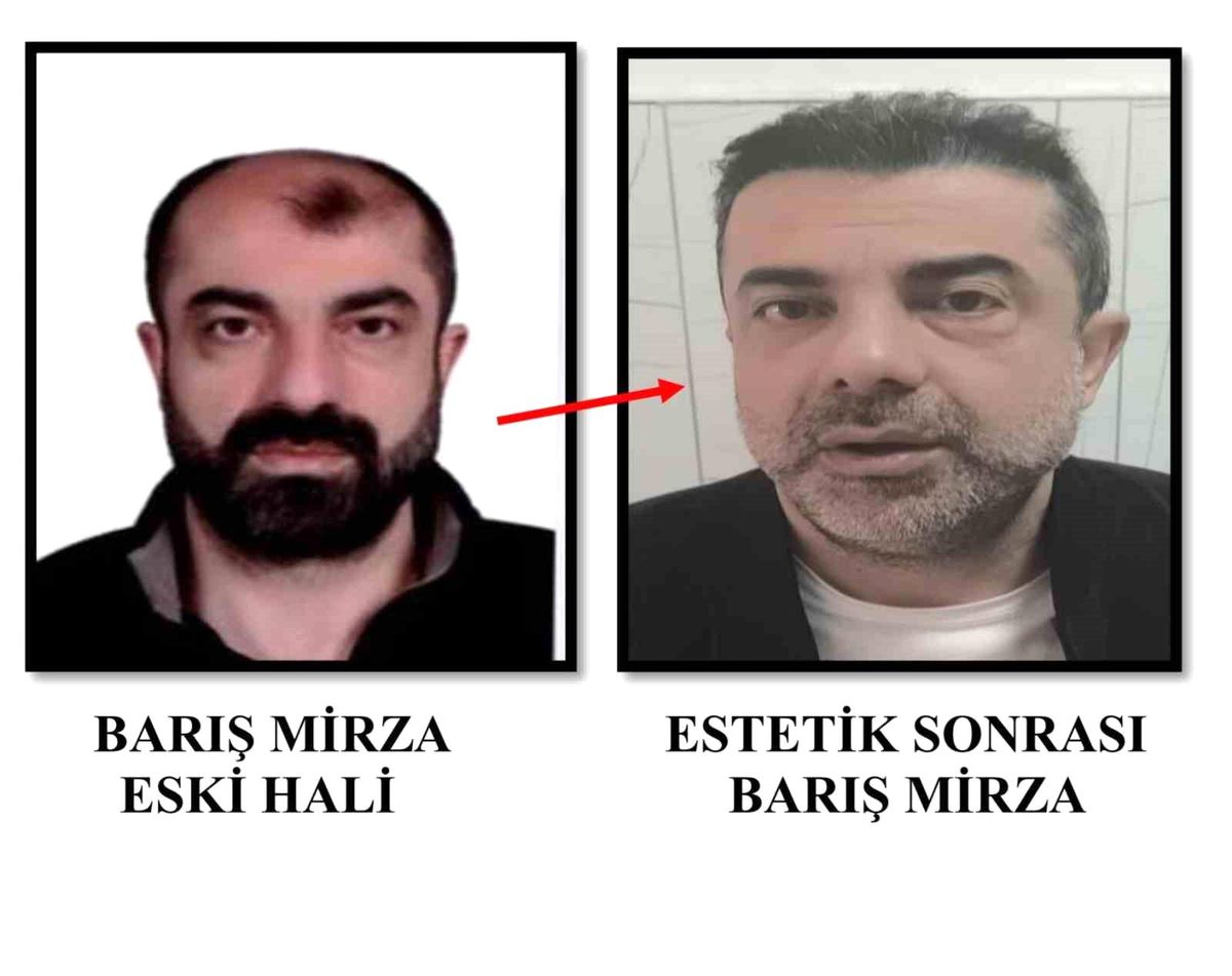 Ameliyat ile yüzünü değiştiren firari cinayet zanlısı, 7 yıl sonra yakalandı