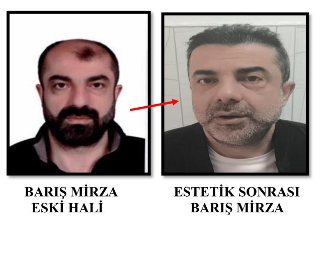 cinayet zanlisi estetikle bamb 19760410 1667 1 m