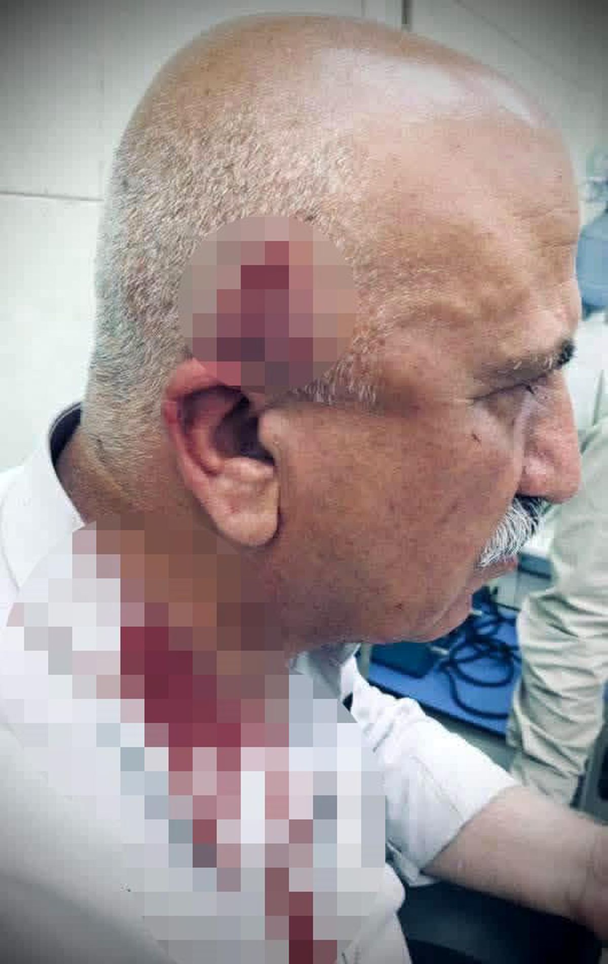 Kerkük'te kaçak yapı yıkımı sırasında kaymakama bıçaklı ve sopalı saldırı